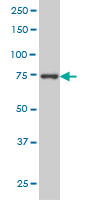 LS-B6197, Western blot of CRSP6 expression in HeLa NE.