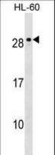 MED18 Antibody western blot of HL-60 cell line lysates (35 ug/lane). The MED18 antibody detected the MED18 protein (arrow).