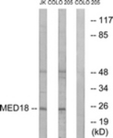 Western blot of extracts from COLO/Jurkat cells, using MED18 Antibody. The lane on the right is treated with the synthesized peptide.