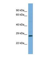 Western blot of Human Jurkat. MED19 antibody dilution 1.0 ug/ml.