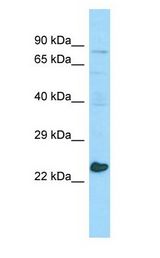 MED20 antibody Western Blot of RPMI-8226.