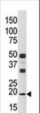 Western blot of anti-NME3 antibody in CEM cell line tissue lysate (35 ug/lane). NME3(arrow) was detected using the purified antibody.