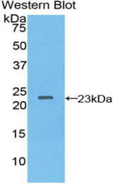 Western blot of recombinant NME3.