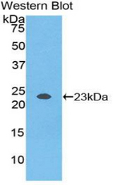 Western blot of recombinant NME3.