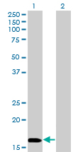 Western blot of NME3 expression in transfected 293T cell line by NME3 monoclonal antibody (M13), clone 3G10.