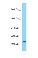 MED21 / SURB7 antibody LS-C146262 Western blot of HeLa Cell lysate. Antibody concentration 1 ug/ml.