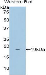 Western blot of recombinant NME4.