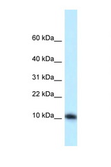 MED21 / SURB7 antibody LS-C145912 Western blot of Mouse Liver lysate. Antibody concentration 1 ug/ml.