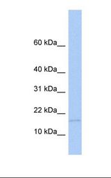Fetal brain lysate. Antibody concentration: 1.0 ug/ml. Gel concentration: 10-20%.