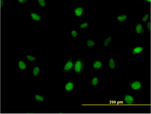 Immunofluorescence of monoclonal antibody to SURB7 on HeLa cell. [antibody concentration 10 ug/ml]