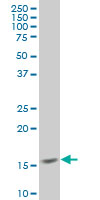 SURB7 monoclonal antibody (M08), clone 3E9 Western blot of SURB7 expression in HeLa.
