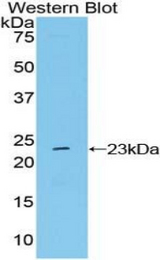 Western blot of recombinant NME6.