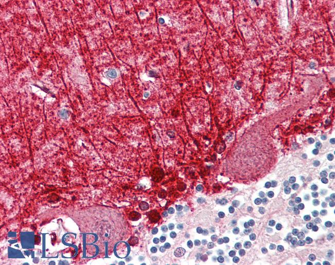 Anti-MED21 antibody IHC of human brain, cerebellum. Immunohistochemistry of formalin-fixed, paraffin-embedded tissue after heat-induced antigen retrieval. Antibody LS-B8410 dilution 5 ug/ml.