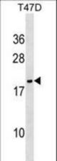 NME6 Antibody western blot of T47D cell line lysates (35 ug/lane). The NME6 antibody detected the NME6 protein (arrow).