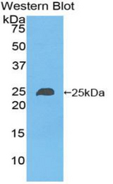 Western blot of recombinant NME6.