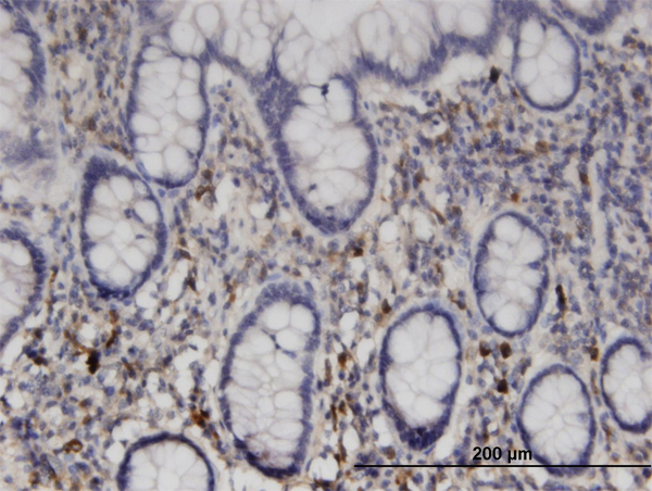 Immunoperoxidase of monoclonal antibody to NME6 on formalin-fixed paraffin-embedded human small Intestine. [antibody concentration 3 ug/ml]