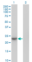 Western blot of NME6 expression in transfected 293T cell line by NME6 monoclonal antibody (M07), clone 2A10.