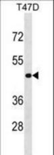NME7 Antibody (V40) western blot of T47D cell line lysates (35 ug/lane). The NME7 antibody detected the NME7 protein (arrow).