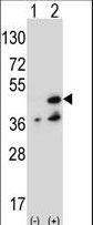 Western blot of NME7 (arrow) using rabbit polyclonal NME7 Antibody (V40). 293 cell lysates (2 ug/lane) either nontransfected (Lane 1) or transiently transfected (Lane 2) with the NME7 gene.