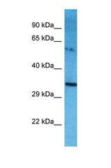 Western blot of Human A549. NME9 antibody dilution 1.0 ug/ml.