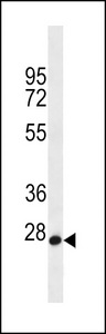 MED22 Antibody western blot of HL-60 cell line lysates (35 ug/lane). The MED22 antibody detected the MED22 protein (arrow).