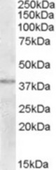 Antibody (2 ug/ml) staining of Human Uterus lysate (35 ug protein in RIPA buffer). Primary incubation was 1 hour. Detected by chemiluminescence