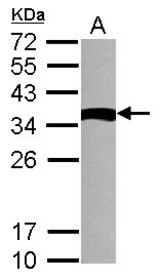 Sample (30 ug of whole cell lysate) A: NT2D1 12% SDS PAGE TXNDC6 antibody diluted at 1:1000