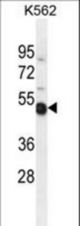 TXNDC6 Antibody western blot of K562 cell line lysates (35 ug/lane). The TXNDC6 antibody detected the TXNDC6 protein (arrow).