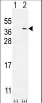 Western blot of TXNDC6 (arrow) using rabbit polyclonal TXNDC6 Antibody. 293 cell lysates (2 ug/lane) either nontransfected (Lane 1) or transiently transfected (Lane 2) with the TXNDC6 gene.