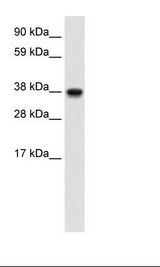 Fetal Liver Lysate