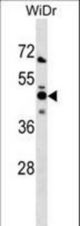 NMI Antibody western blot of WiDr cell line lysates (35 ug/lane). The NMI antibody detected the NMI protein (arrow).