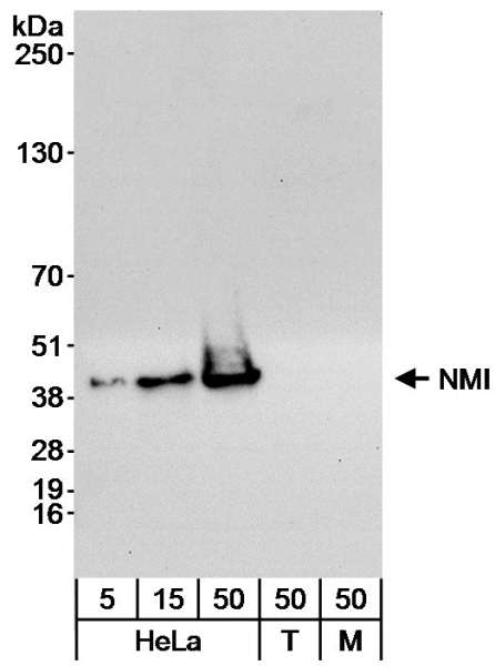 Detection of Human NMI by Western Blot. Samples: Whole cell lysate from HeLa (5, 15 and 50 ug), 293T (T; 50 ug) and NIH3T3 (M; 50 ug) cells. Antibody: Affinity purified rabbit anti-NMI antibody used at 0.04 ug/ml for WB. Detection: Chemiluminescence with an exposure time of 30 seconds.