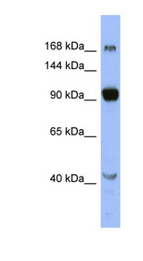 MED23 / DRIP130 antibody LS-C109980 Western blot of OVCAR-3 cell lysate.