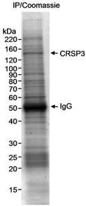 Detection of Human CRSP3 by Immunoprecipitation. Samples: Nuclear extract (5 mg) from HeLa cells. Antibody: Affinity purified rabbit anti-CRSP3 antibody used at 4 ug/5 mg extract. Detection: Coomassie stain. The identity of the band that is CRSP3 was verified by mass spectrometry.