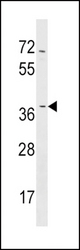 NMNAT2 Antibody western blot of NCI-H460 cell line lysates (35 ug/lane). The NMNAT2 antibody detected the NMNAT2 protein (arrow).