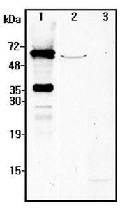 Western blot analysis using anti-NMNAT2 (human), pAb at 1:4000 dilution. 1: Human NMNAT2 (His-tagged) (50ng). 2: Human mesenchymal stem cell lysate (V1T1) (50 ug). 3: Unrelated Protein (His-tagged) (50ng).