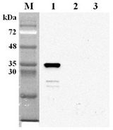 Western blot analysis using anti-NMNAT2 (human), mAb (Nady-1) at 1:2000 dilution. 1: Human NMNAT2 (His-tagged). 2: Human NMNAT3 (His-tagged). 3: Unrelated (His-tagged) (negative control).