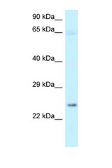 NMNAT3 antibody LS-C146033 Western blot of Fetal Brain lysate. Antibody concentration 1 ug/ml.