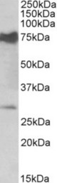 NMNAT3 antibody (0.5 ug/ml) staining of Mouse Heart lysate (35 ug protein in RIPA buffer). Primary incubation was 1 hour. Detected by chemiluminescence.