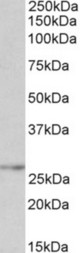 NMNAT3 antibody (0.1 ug/ml) staining of Human Kidney lysate (35 ug protein in RIPA buffer). Primary incubation was 1 hour. Detected by chemiluminescence.