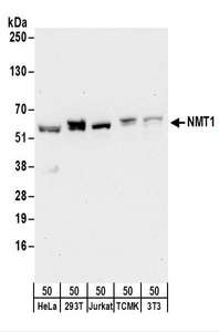 Detection of Human and Mouse NMT1 by Western Blot. Samples: Whole cell lysate (50 ug) from HeLa, 293T, Jurkat, mouse TCMK-1, and mouse NIH3T3 cells. Antibodies: Affinity purified rabbit anti-NMT1 antibody used for WB at 0.1 ug/ml. Detection: Chemiluminescence with an exposure time of 30 seconds.