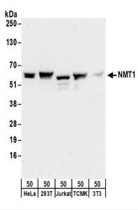 Detection of Human and Mouse NMT1 by Western Blot. Samples: Whole cell lysate (50 ug) from HeLa, 293T, Jurkat, mouse TCMK-1, and mouse NIH3T3 cells. Antibodies: Affinity purified rabbit anti-NMT1 antibody used for WB at 0.1 ug/ml. Detection: Chemiluminescence with an exposure time of 30 seconds.