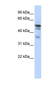 NMT1 antibody LS-C102217 Western blot of HepG2 cell lysate.