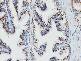 IHC of paraffin-embedded Human prostate tissue using anti-NMT2 mouse monoclonal antibody.