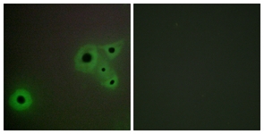 Immunofluorescence of A549 cells, using MED23 Antibody. The picture on the right is treated with the synthesized peptide.