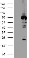 HEK293T cells were transfected with the pCMV6-ENTRY control (Left lane) or pCMV6-ENTRY NMT2 (Right lane) cDNA for 48 hrs and lysed. Equivalent amounts of cell lysates (5 ug per lane) were separated by SDS-PAGE and immunoblotted with anti-NMT2.