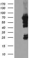 HEK293T cells were transfected with the pCMV6-ENTRY control (Left lane) or pCMV6-ENTRY NMT2 (Right lane) cDNA for 48 hrs and lysed. Equivalent amounts of cell lysates (5 ug per lane) were separated by SDS-PAGE and immunoblotted with anti-NMT2.