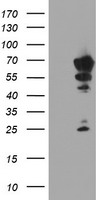 HEK293T cells were transfected with the pCMV6-ENTRY control (Left lane) or pCMV6-ENTRY NMT2 (Right lane) cDNA for 48 hrs and lysed. Equivalent amounts of cell lysates (5 ug per lane) were separated by SDS-PAGE and immunoblotted with anti-NMT2.