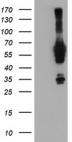 HEK293T cells were transfected with the pCMV6-ENTRY control (Left lane) or pCMV6-ENTRY NMT2 (Right lane) cDNA for 48 hrs and lysed. Equivalent amounts of cell lysates (5 ug per lane) were separated by SDS-PAGE and immunoblotted with anti-NMT2.
