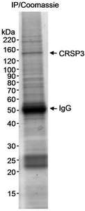 Detection of Human CRSP3 by Immunoprecipitation. Samples: Nuclear extract (5 mg) from HeLa cells. Antibody: Affinity purified rabbit anti-CRSP3 antibody used at 4 ug/5 mg extract. Detection: Coomassie stain. The identity of the band that is CRSP3 was verified by mass spectrometry.